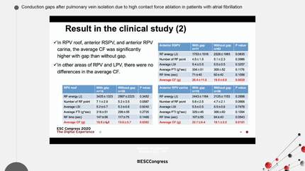 Conduction gaps after pulmonary vein isolation due to high contact force ablation in patients with atrial fibrillation