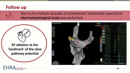 Presentation thumbnail