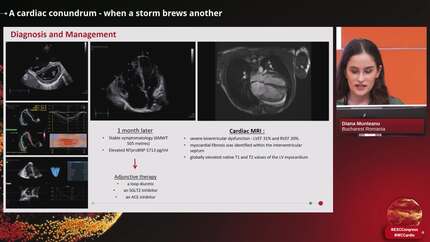 A cardiac conundrum - when a storm brews another