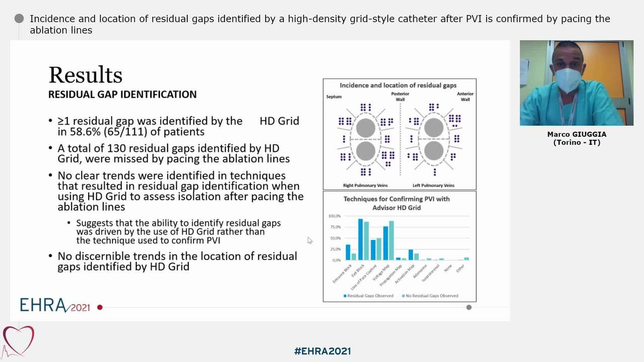Incidence and location of residual gaps identified by a high-density grid-style catheter after PVI is confirmed by pacing the ablation lines