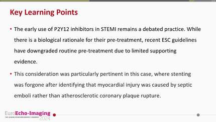 Thinking outside of the box: a case of infective endocarditis with an unexpected presentation