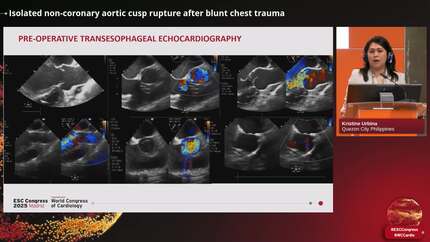 Presentation thumbnail