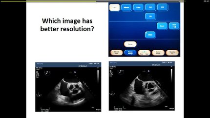 Essentials for ultrasound: physics, instrumentation, settings.