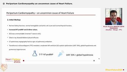 Peripartum Cardiomyopathy  an uncommon cause of Heart Failure.