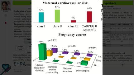 Real pregnancy heart team work: insights from a single-center experience