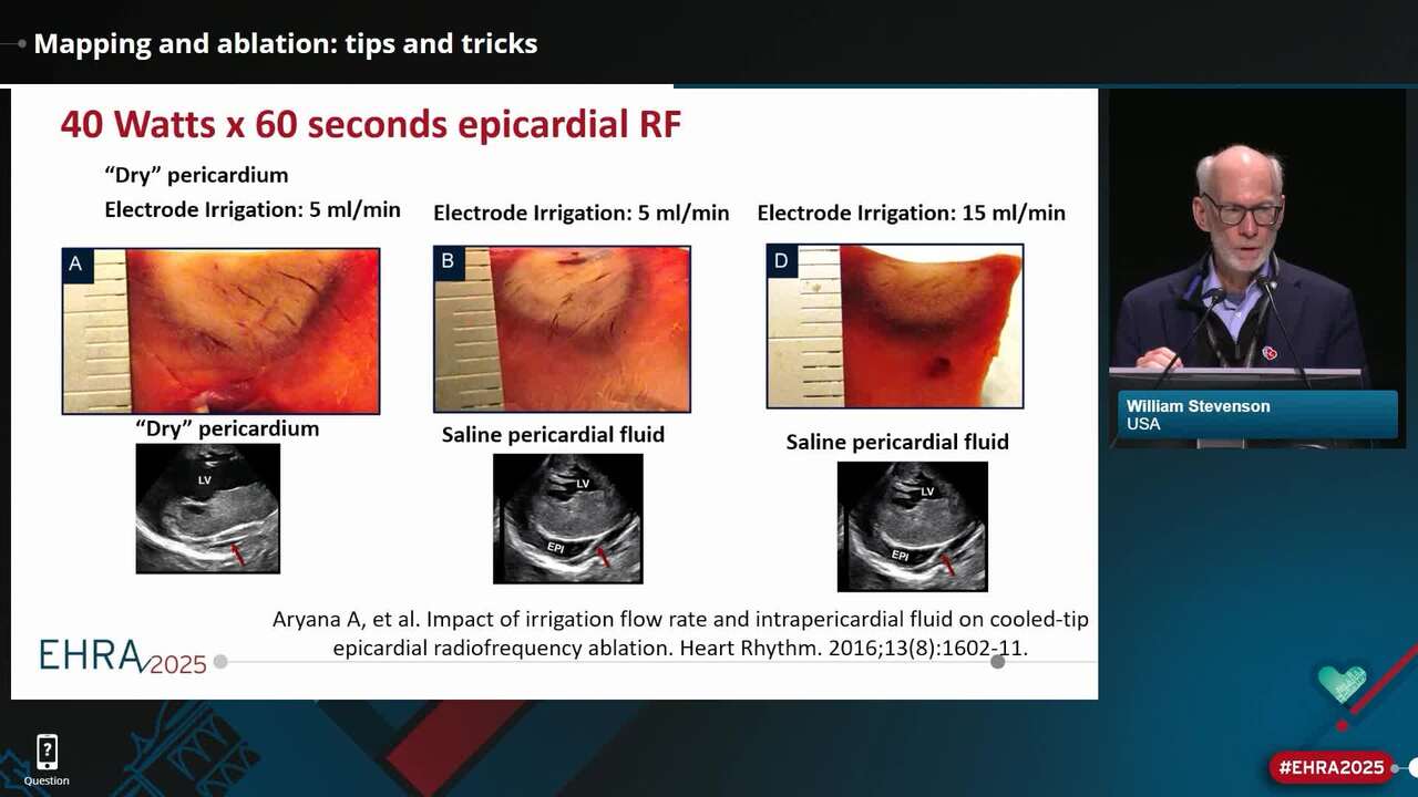 Epicardial Ventricular Arrhythmia Ablation: a Clinical Consensus Statement of the EHRA/HRS/APHRS/LAHRS/CHRS