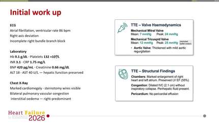 The forgotten valves? Tricuspid and prosthetic valve disease