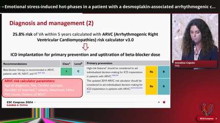 Emotional stress-induced hot-phases in a patient with a desmoplakin-associated arrhythmogenic cardiomyopathy?