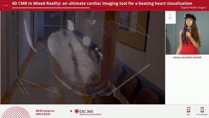 4D CMR in Mixed Reality: an ultimate cardiac imaging tool for a beating heart visualization