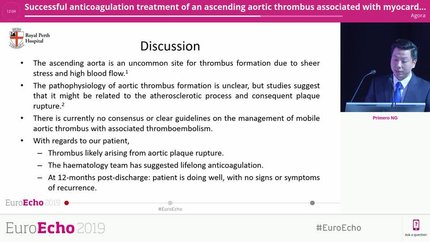Successful anticoagulation treatment of an ascending aortic thrombus associated with myocardial infarction and systemic embolism