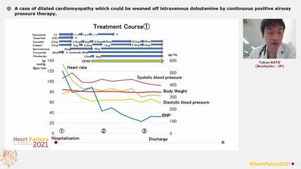 A case of dilated cardiomyopathy which could be weaned off intravenous dobutamine by continuous positive airway pressure therapy.