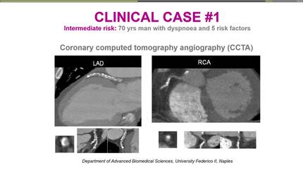 Presentation thumbnail