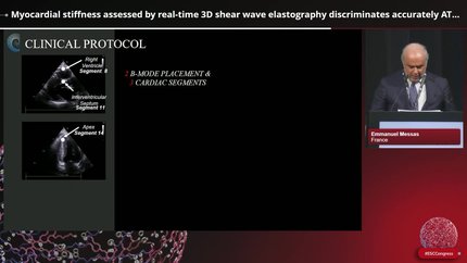 Presentation thumbnail