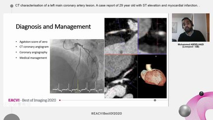 CT characterisation of a left main coronary artery lesion. A case report of 29 year old with ST elevation and myocardial infarction.
.