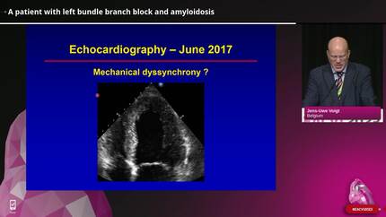 Challenging cases with cardiac amyloidosis