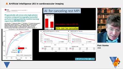 How to apply AI in (hybrid) nuclear cardiology?