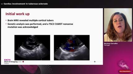 Presentation thumbnail
