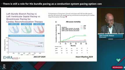 Presentation thumbnail