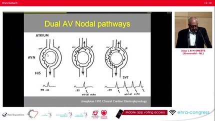 Understanding the AV-node: anatomy, fluoroscopic anatomy and catheter positions.