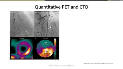 Radionuclide imaging (perfusion and viability)