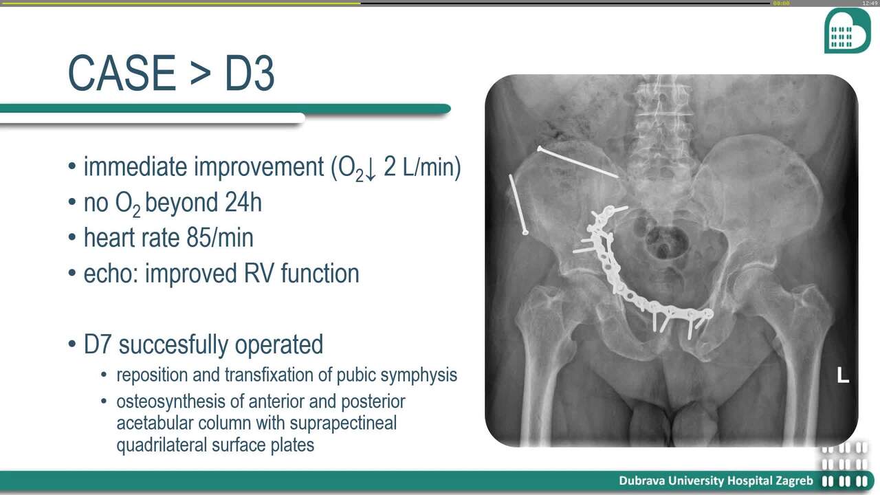 Presentation thumbnail