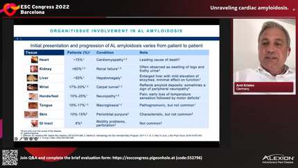 Unraveling cardiac amyloidosis.