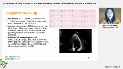 The Role of Early Cardiovascular Risk Screening in Rare Inflammatory disease: A Novel Case.