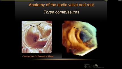 Presentation thumbnail