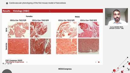 Cardiovascular phenotyping of the first mouse model of Sarcoidosis