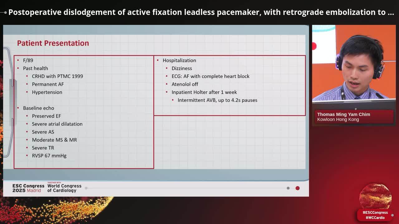 Complications in cardiac implantable devices