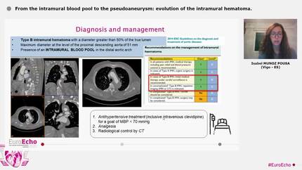 From the intramural blood pool to the pseudoaneurysm: evolution of the intramural hematoma.