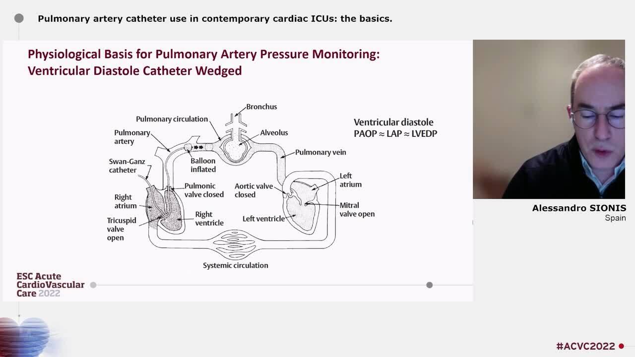 Pulmonary artery catheter use in contemporary cardiac ICUs: the basics.