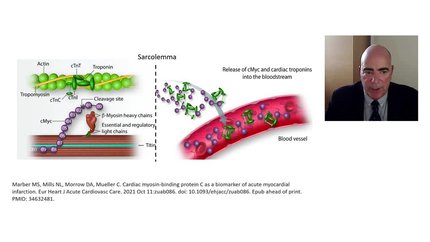ACVC Biomarker Talk Series - A new diagnostic marker on the horizon - cMyC