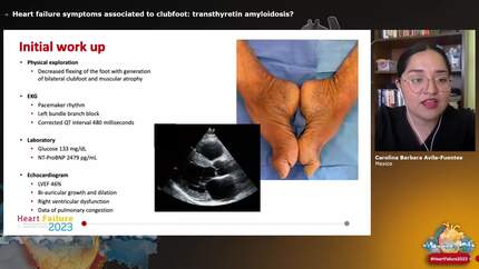Presentation thumbnail
