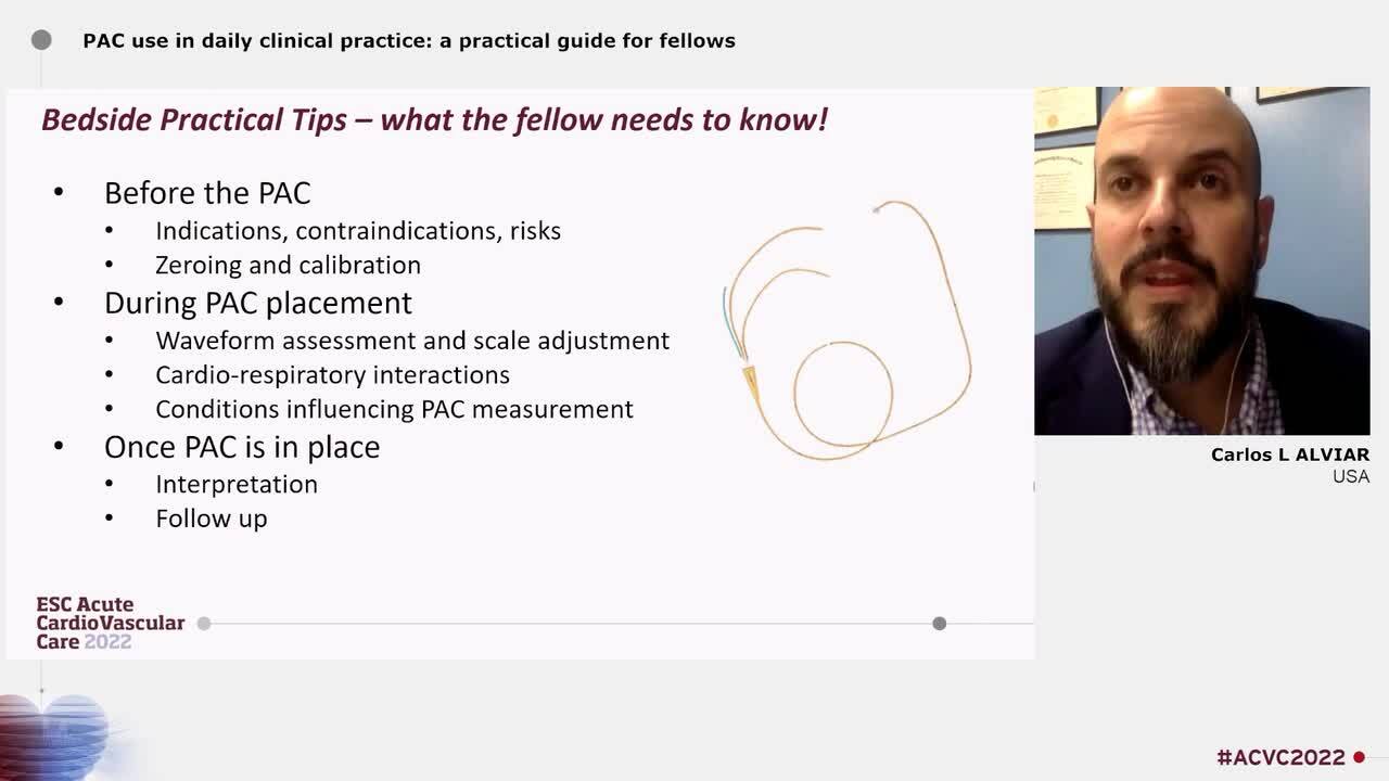 The pulmonary artery catheter in contemporary cardiac ICUs 