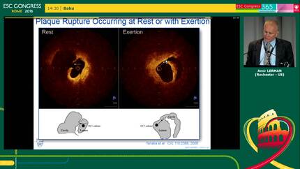 Presentation thumbnail
