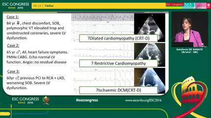 Incremental value of cardiac magnetic resonance over echocardiography in the management and clinical decision-making in acute hospitalised patients