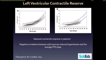 Stress imaging in coarctation.