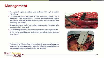 Limited aortic intimal tear- Break the vicious cycle