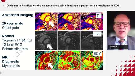 Guidelines in Practice: working up acute chest pain – imaging in a patient with a nondiagnostic ECG