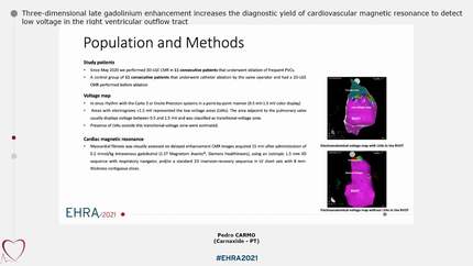 Three-dimensional late gadolinium enhancement increases the diagnostic yield of cardiovascular magnetic resonance to detect low voltage in the right ventricular outflow tract