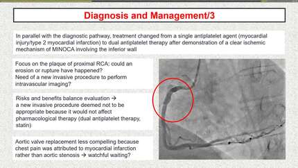 An obvious case of chest pain, aortic stenosis, and hypertension. Or not?