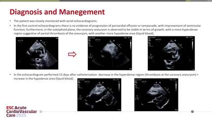 Presentation thumbnail