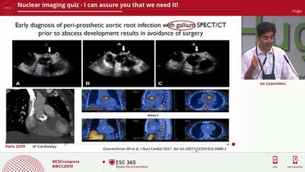 Nuclear imaging quiz - I can assure you that we need it!
