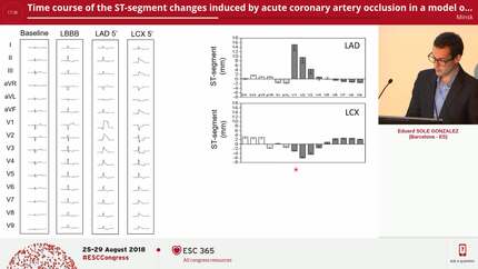 Time course of the ST-segment changes induced by acute coronary artery occlusion in a model of left bundle branch block in pigs