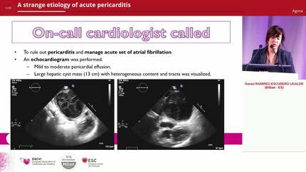 A strange etiology of acute pericarditis