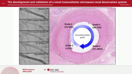 The development and validation of a novel transcatheter microwave renal denervation system