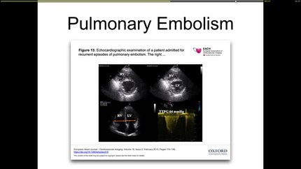 Presentation thumbnail