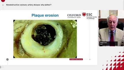 Presentation thumbnail