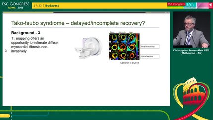 Presentation thumbnail
